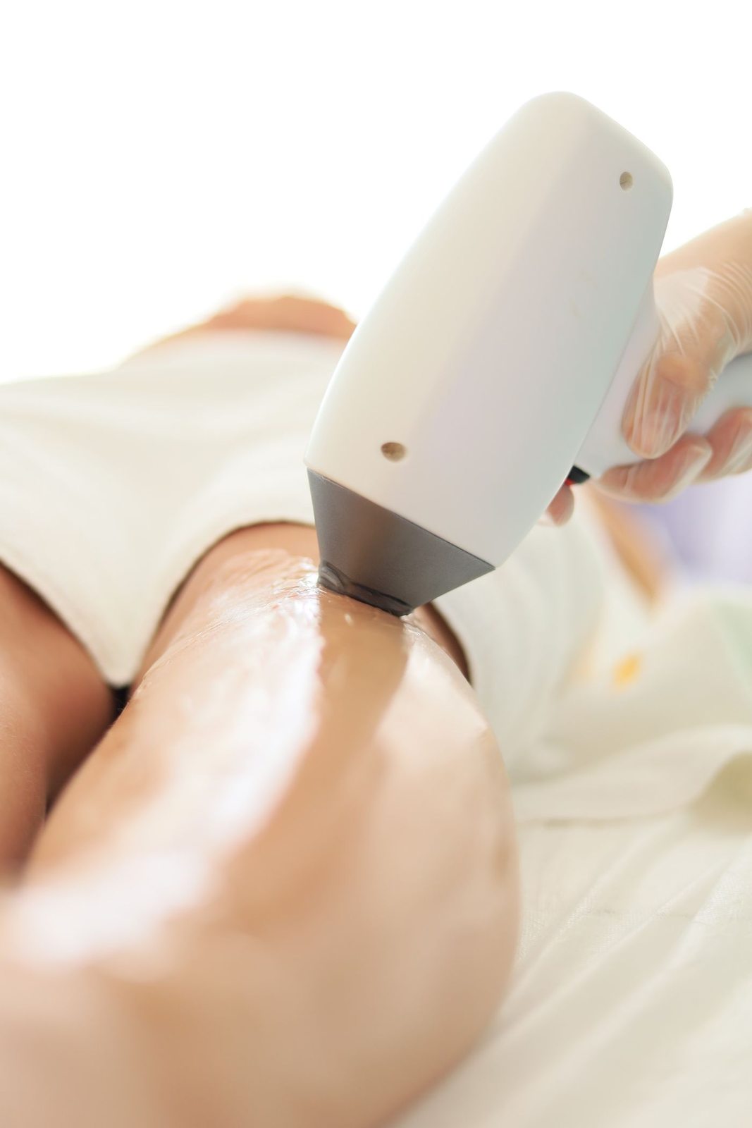 Laser Hair Removal in Mississauga, step 1: skin assessment