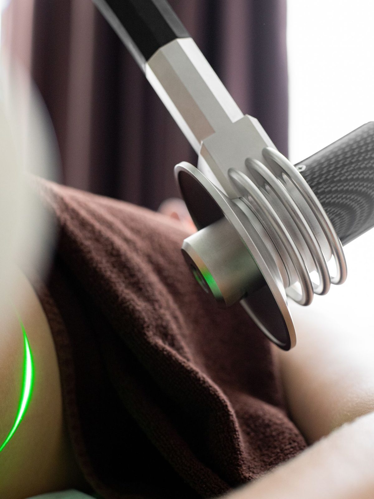 Vein Treatment in Mississauga, step 3: treatment